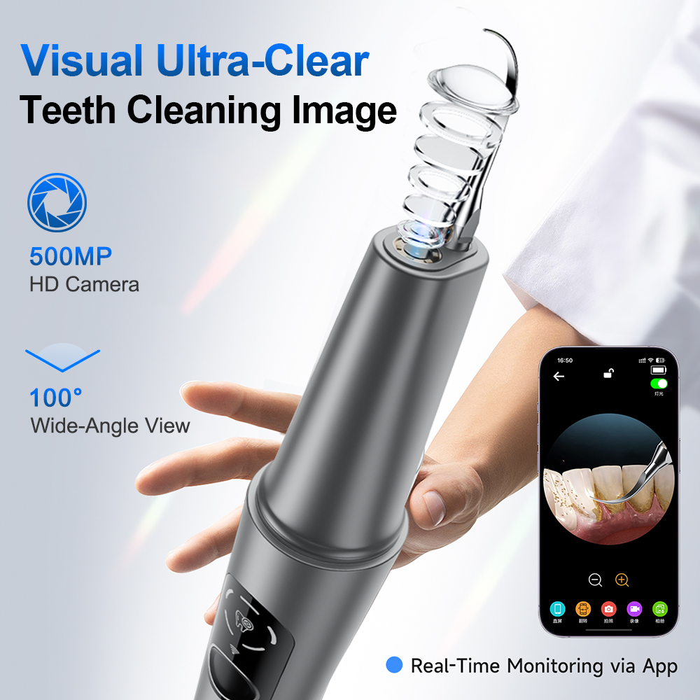 เครื่องขูดหินปูนอัลตราโซนิกแบบ - Lighting Visual บทวิจารณ์และราคา